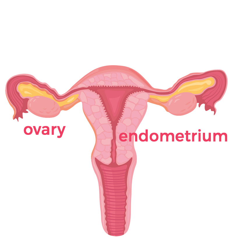 Ovarian and endometrium cancer